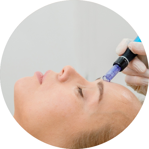 Mezoterapia igłowa Bydgoszcz